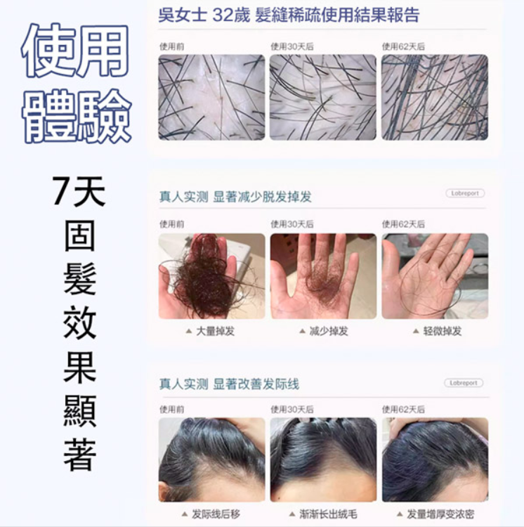 益生元洗髮水 -6